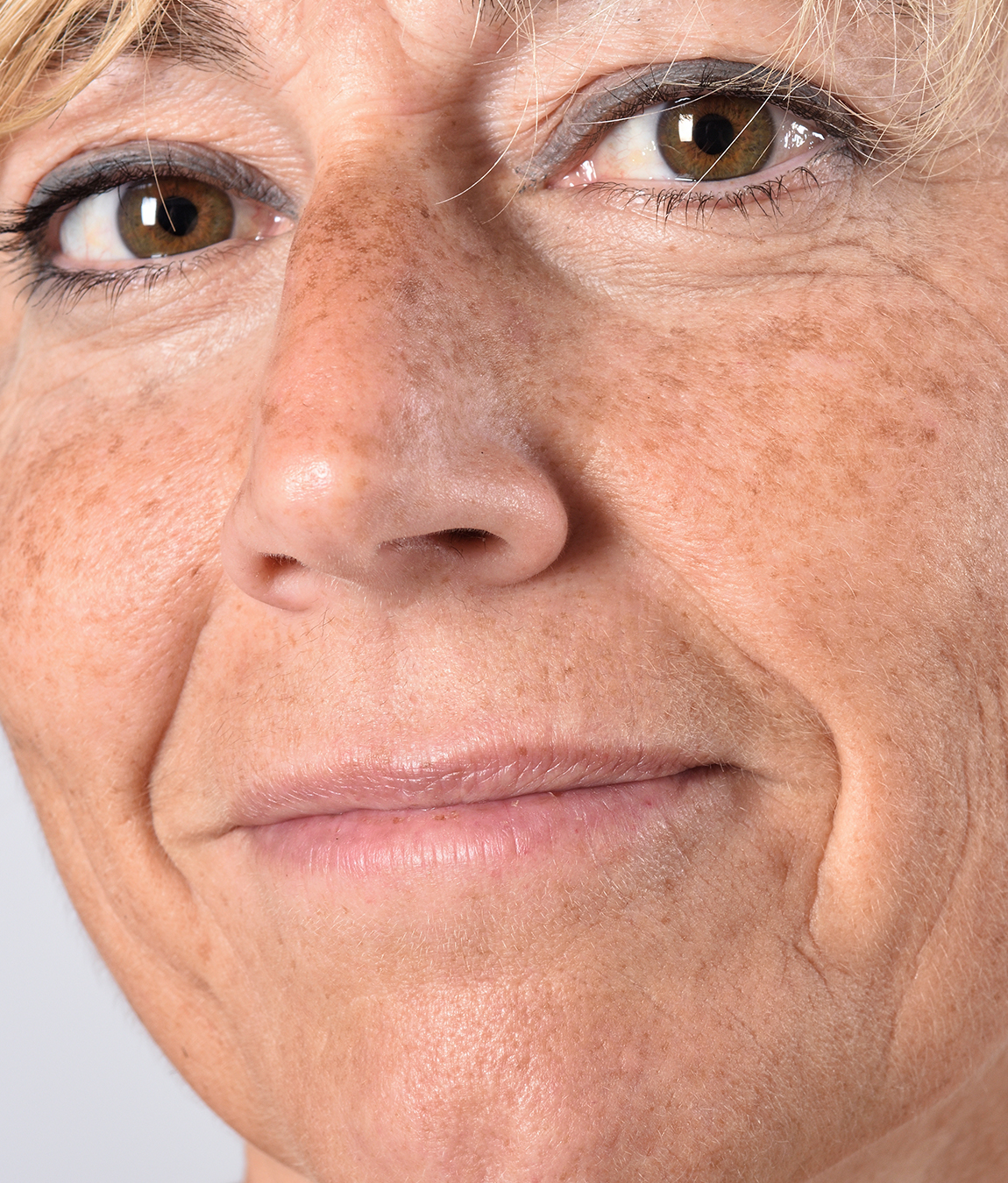 Close-up on a woman's age spots